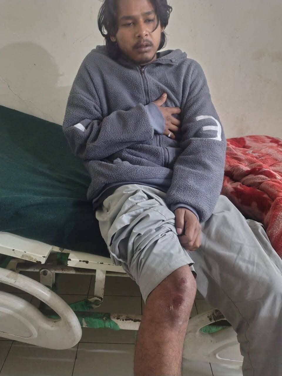 चमोली
ब्रीकिंग
देर रात एक ही परिवार के चार लोगों पर भालू ने किया हमला जनपद चमोली के दूरस्थ विकासखंड जोशीमठ की घटना, घायलों की गंभीरता को देखते हुए किया गया हायर सेंटर रेफर, भालू के हमले के चलते लोगों में दहशत।