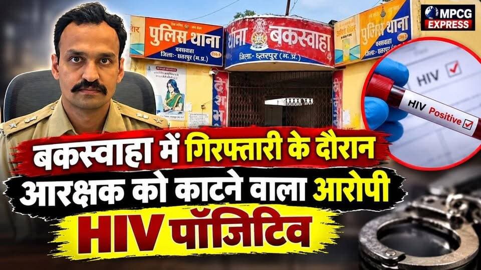 बकस्वाहा में गिरफ्तारी के दौरान आरक्षक को काटने वाला आरोपी HIV पॉजिटिव