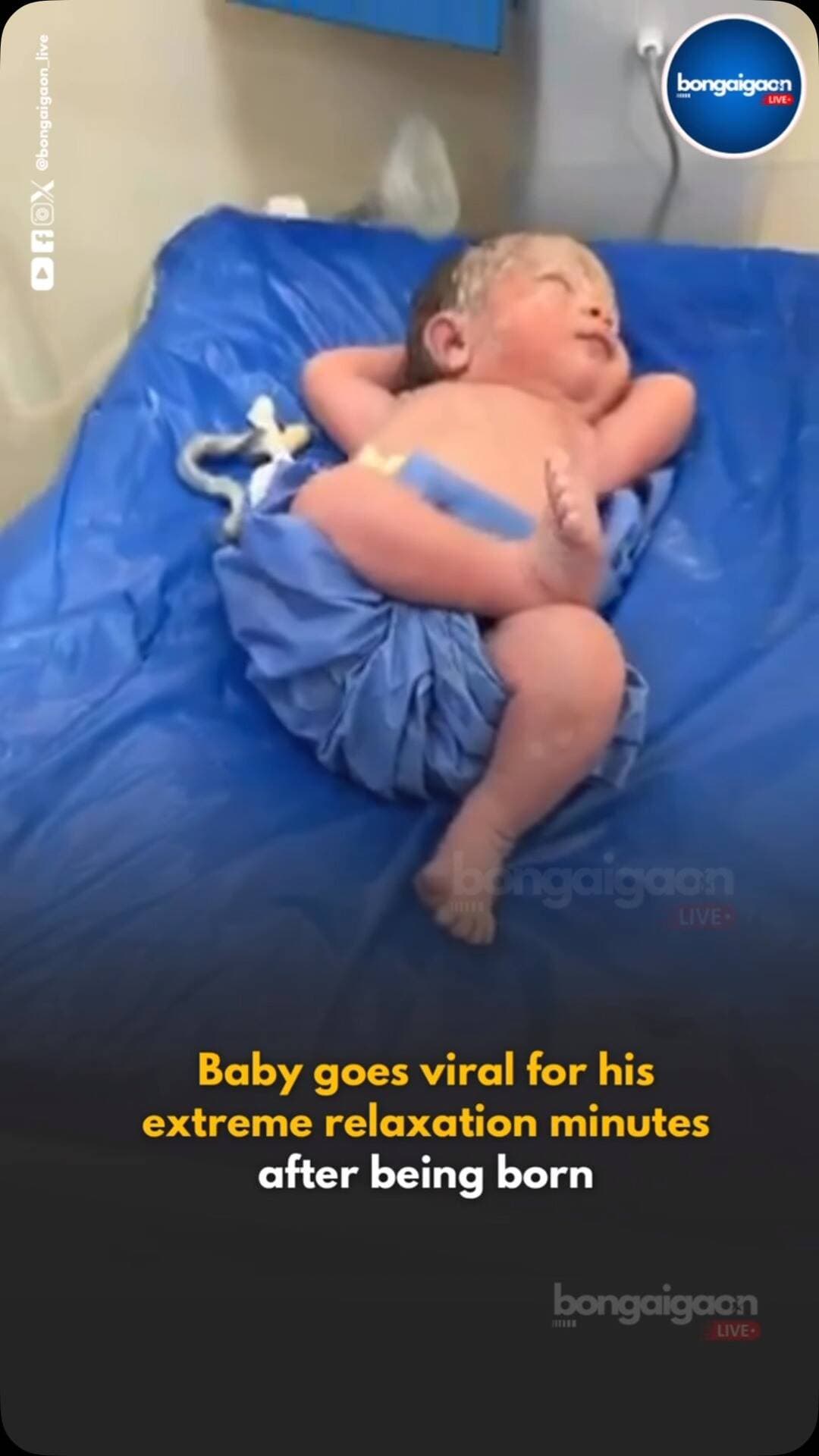 #WATCH | Baby goes viral for his extreme relaxation minutes after being born.