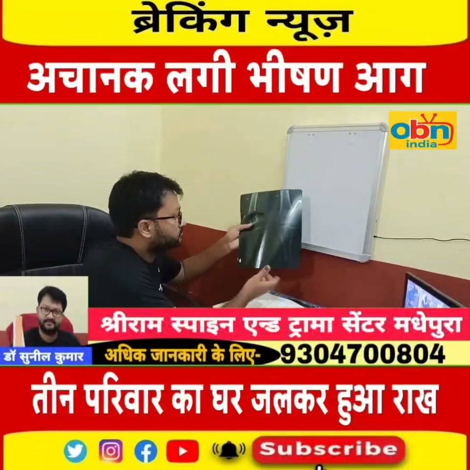 मधेपुरा में भीषण अग्निकांड, तीन परिवारों के घर जलकर राख; लाखों की क्षति