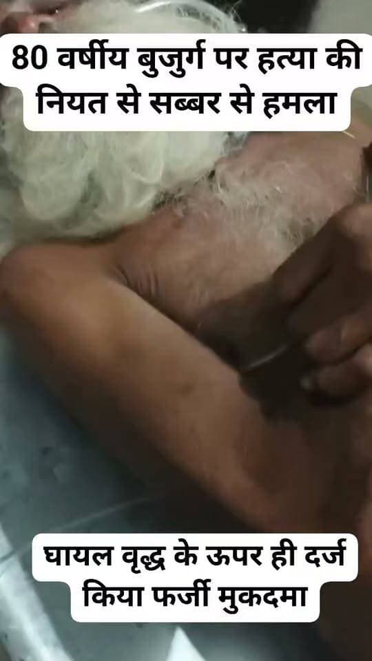 80 वर्षीय बुजुर्ग पर हत्या की नियत से सब्बर से हमला बेहोसी की हालत में लाया गया अस्प्ताल