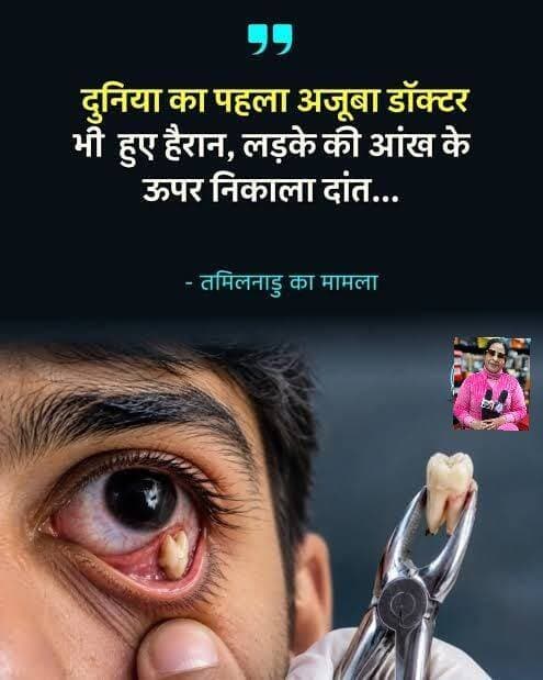 Image post