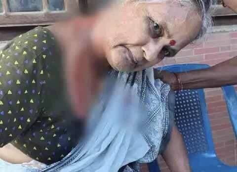 ఉంగుటూరు: ఏలూరు జిల్లాలో కోతి దాడి: మాజీ సర్పంచ్కు తీవ్ర గాయాలు