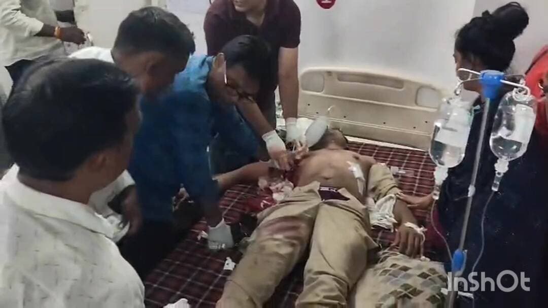धार: धार के धामनोद में पुलिसकर्मी पर गोली, गंभीर हालत में इंदौर रेफर