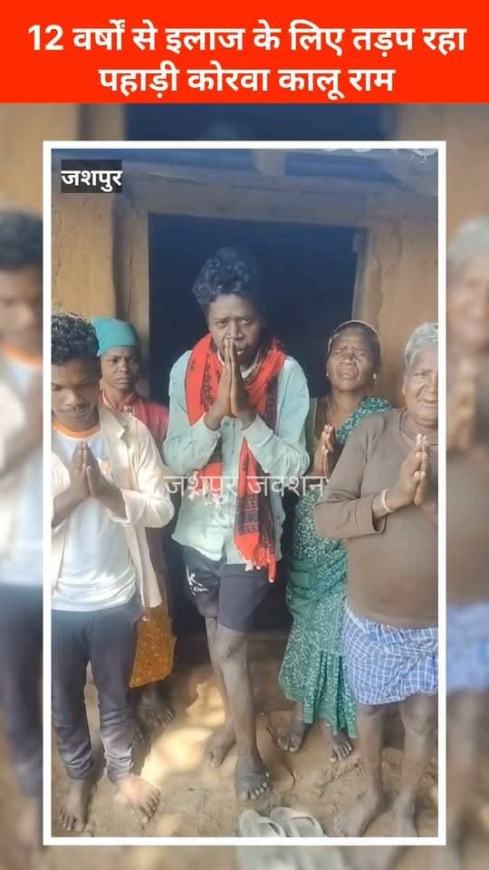 सेवा संकल्प अभियान की असली सार्थकता यहीं है...
जशपुर में चल रहा सेवा संकल्प अभियान समाज के जरूरतमंद और वंचित परिवारों तक मदद पहुंचाने का संकल्प है। लेकिन किसी अभियान की सफलता केवल कार्यक्रमों और आयोजनों से नहीं, बल्कि उस मदद से तय होती है जो जरूरत के समय किसी जिंदगी को संभाल सके।
सन्ना तहसील के ग्राम कर्रीकोना का 32 वर्षीय पहाड़ी कोरवा युवक कालू राम पिछले 12 वर्षों से गंभीर बीमारी से जूझ रहा है। इलाज के लिए परिवार जमीन तक बेच चुका है। पत्नी विकलांग हैं, दो छोटे बच्चे और माता-पिता की जिम्मेदारी है और अब परिवार के पास इलाज कराने के लिए भी पैसे नहीं हैं।
ऐसे में यदि सेवा संकल्प अभियान के माध्यम से कालू राम तक प्रशासन और समाज की मदद पहुंचती है, उसे बेहतर अस्पताल में इलाज मिलता है और उसका परिवार फिर से उम्मीद के साथ जीवन जी पाता है, तो यही इस अभियान की सही मायनों में सफलता होगी।
आज जरूरत एक और कार्यक्रम की नहीं, बल्कि एक बीमार इंसान तक सेवा को पहुंचाने की है। उम्मीद है कि कालू राम की पीड़ा शासन-प्रशासन तक पहुंचेगी और उनका इलाज सुनिश्चित होगा।
#jashpur #CMOChhattisgarh #cghealth