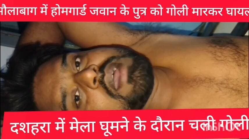 दशहरा घूमने के दौरान होमगार्ड जवान के पुत्र को मौलाबाग में मारी गोली गम्भीर स्थिति में अस्पताल में कराया गया भर्ती