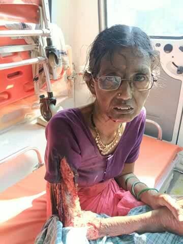 నిర్మల్: నిర్మల్ ఆర్టీసీ బస్సులో ప్రమాదం: జారిపడి వృద్ధురాలికి గాయాలు