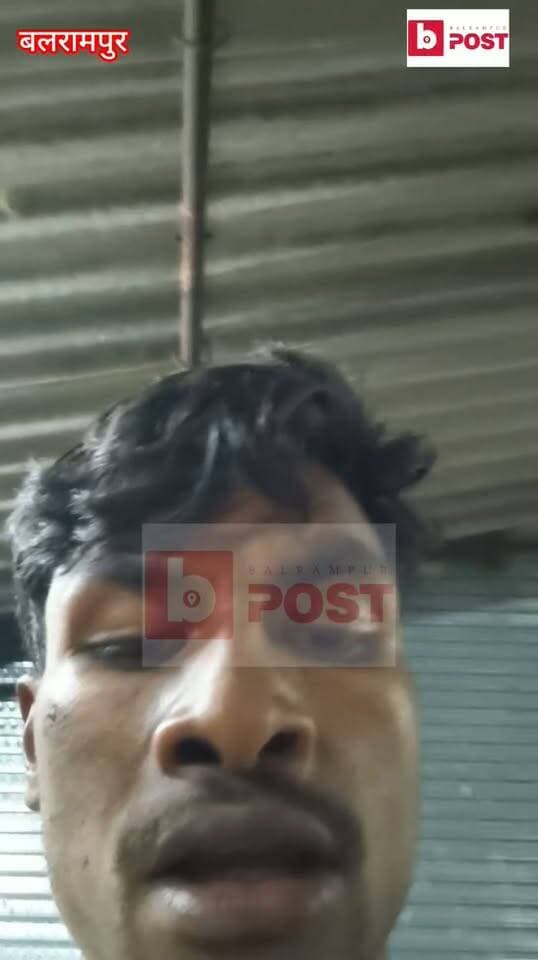 ब्रेकिंग न्यूज़ | बलरामपुर
शेखापुर में प्रधान प्रतिनिधि व महिला प्रधान के परिजनों पर मारपीट और जानलेवा हमले का आरोप!
मंदिर से लौट रहे रौनक अली को रोककर मारपीट करने, सिर पर वार कर घायल करने और मां-बहन से अभद्रता का आरोप। पीड़ित ने कोतवाली देहात में प्रार्थना-पत्र देकर प्राथमिकी दर्ज करने और आरोपियों के खिलाफ कार्रवाई की मांग की।
जल्द देखें खबर ज़ीरो ग्राउंड रिपोर्ट!
खबर शिकायत-पत्र में लगाए गए आरोपों पर आधारित है। पुलिस की आधिकारिक पुष्टि का इंतजार है।