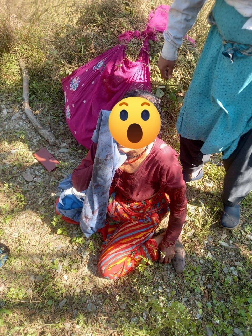 सतपुली के ईड़ा माला गांव में गुलदार का हमला, घास लेने गई लीला देवी गंभीर रूप से घायल
पौड़ी। पहाड़ों में गुलदार की दहशत कम होने का नाम नहीं ले रही है। ताजा मामला सतपुली क्षेत्र के ईड़ा माला गांव का है, जहां घास लेने गई लीला देवी पर गुलदार ने घात लगाकर हमला कर दिया। हमले में महिला गंभीर रूप से घायल हो गई। महिला के शोर मचाने पर गुलदार मौके से भाग निकला। इसके बाद स्थानीय लोगों ने आनन-फानन में घायल महिला को उपचार के लिए हंस अस्पताल पहुंचाया, जहां फिलहाल उनकी स्थिति सामान्य बताई जा रही है। घटना के बाद ग्रामीणों में वन विभाग के प्रति आक्रोश बढ़ता दिखाई दे रहा है। ग्रामीणों का कहना है कि पहाड़ी क्षेत्रों में लोग रोजमर्रा के कामों के लिए जंगलों और आसपास के क्षेत्रों में जाने को मजबूर हैं, लेकिन गुलदार की लगातार सक्रियता के चलते लोगों की सुरक्षा पर खतरा बना हुआ है। ग्रामीणों ने वन विभाग से जल्द से जल्द गुलदार को पकड़ने के लिए पिंजरा लगाने और क्षेत्र में गश्त बढ़ाने की मांग की है। लोगों का कहना है कि समय रहते प्रभावी कदम नहीं उठाए गए तो किसी बड़ी अनहोनी की आशंका से इनकार नहीं किया जा सकता। फिलहाल, घटना के बाद क्षेत्र में भय का माहौल है और ग्रामीण गुलदार की दहशत से निजात दिलाने के लिए वन विभाग की कार्रवाई का इंतजार कर रहे हैं।