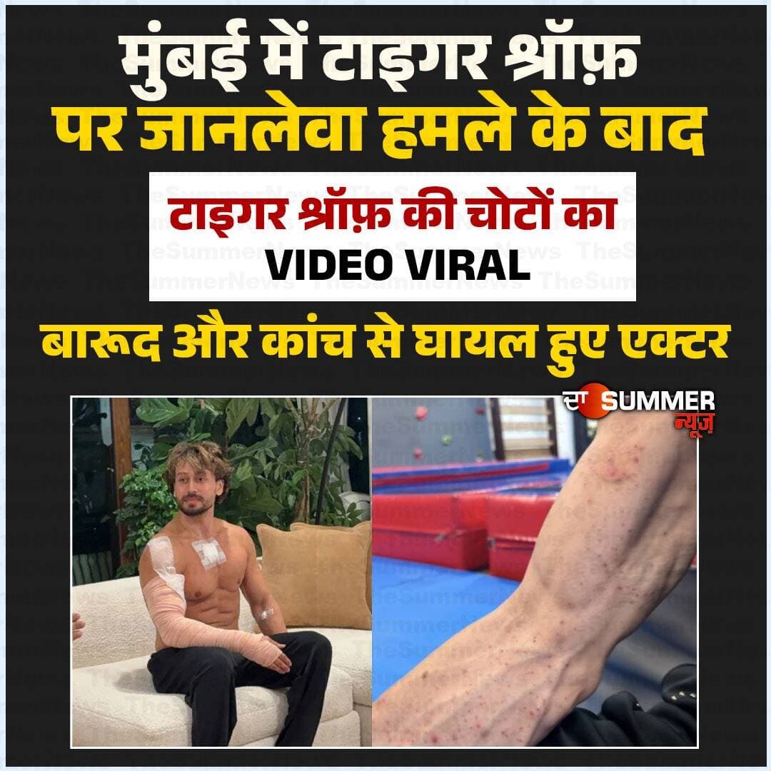 टाइगर श्रॉफ़ की चोटों का Video Viral