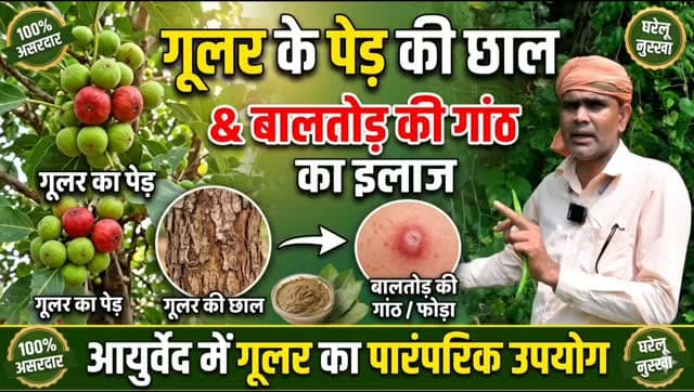 🌿 गूलर की छाल और बालतोड़ की गांठ | औषधीय पौधे की जानकारी
गूलर एक पारंपरिक औषधीय पौधा है। 🌳 आयुर्वेद में इसकी छाल का पारंपरिक उपयोग बताया गया है।
⚠️ बालतोड़ की लाल, दर्दनाक या मवाद वाली गांठ को दबाएँ नहीं। गूलर की छाल से इसके ठीक होने के पर्याप्त वैज्ञानिक प्रमाण नहीं हैं। जरूरत पड़ने पर डॉक्टर से सलाह लें।
🌱 औषधीय पौधों को पहचानें, उनका संरक्षण करें और प्रकृति से जुड़ें।
#गूलर #औषधीयपौधे #आयुर्वेद #प्रकृतिसंरक्षण #जड़ीबूटी