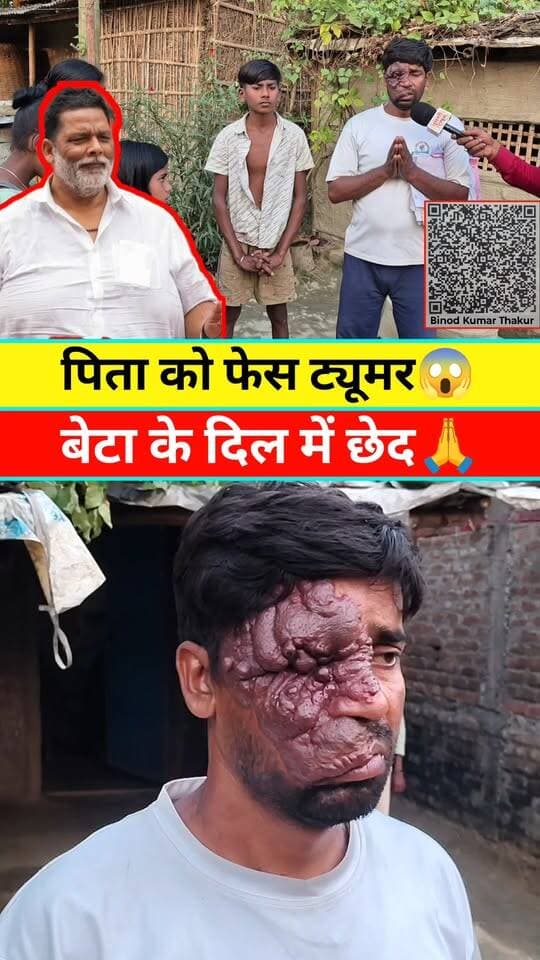 चेहरा खराब है, कम पर कोई नहीं रखता,है डर जाता है, बेटा के दिल में छेद है, #Pleasehelp #Viral #Reels #Video #Pappuyadav #Mp