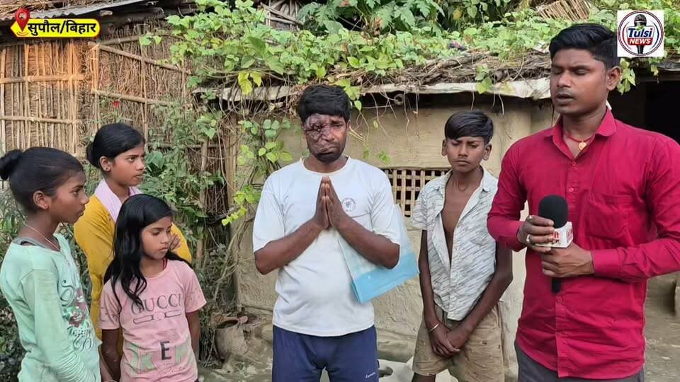 बेटे का इलाज करने में,पिता का चेहरा हुआ खराब #helping #Video #Viral #Interview #News