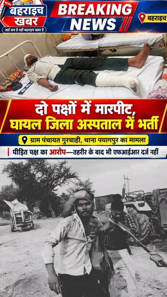 पयागपुर थाना क्षेत्र में दो पक्षों के बीच जमकर हुईं मारपीट मामले में एक पक्ष को आई गंभीर चोटें,जिला अस्पताल में चल रहा इलाज,पीड़ित पक्ष का आरोप—तहरीर के बावजूद पयागपुर पुलिस ने दर्ज नहीं की एफआईआर।
#Bahraich #BahraichKhabar #Payagpur #UPPolice #BreakingNews #CrimeNews #BahraichNews
UP Police DM office bahraich Bahraich Police