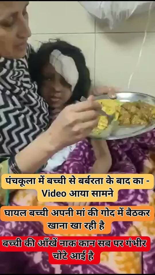 पंचकूला में बच्ची से बर्बरता के बाद का - Video आया सामने
घायल बच्ची अपनी मां की गोद में बैठकर खाना खा रही है
चेहरे और नाक पर चोट के निशान साफ दिख रहे हैं।
बच्ची की आँखें नाक कान सब पर गंभीर चोटे आई है
#PanchkulaNews
