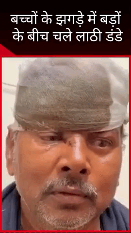 मदेयगंज थाना अंतर्गत क्षेत्र में बच्चों के झगड़े के बीच बड़ों के बीच चले लाठी-डंडे, फूटा सिर
