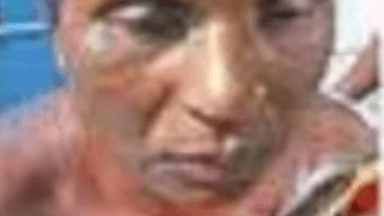 डुमरिया: लखाईडीह आवासीय विद्यालय में रसोइया झुलसी, गंभीर हालत में एमजीएम जमशेदपुर रेफर