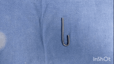 विदिशा नगर: 8 माह के बच्चे के गले, मुंह में फंसी लोहे की रॉड, मेडिकल कॉलेज में ऑपरेशन कर बचाई जान