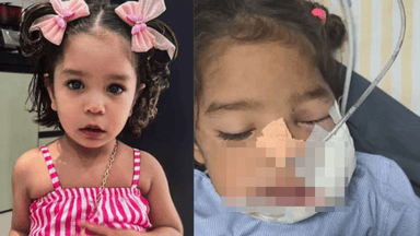 राजस्थान के अलवर में टॉफी चबाते ही बच्ची के मुंह में हुआ विस्फोट, फट गया जबड़ा