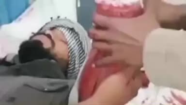 सरवाड़: सरवाड़ दरगाह क्षेत्र में आपसी कहासुनी में धारदार हथियार से एक युवक का हाथ काटा गया, पुलिस जुटी मामले की जांच में