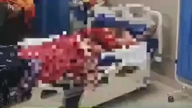 पयागपुर: दिगित पुरवा में आग से झुलसी महिला का इलाज जारी