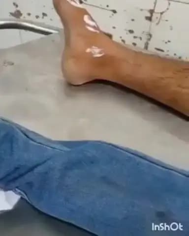 बरहज: सोनाड़ी मोड़ के पास दो बाइकों की आमने-सामने टक्कर, चार लोग हुए घायल