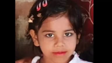 बिलारी: रुस्तमपुर सराय में आवारा कुत्तों के हमले में बच्ची गंभीर रूप से घायल, दिल्ली किया गया रेफर