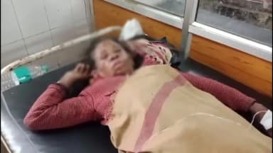 बड़वारा: मझगवा में युवक ने महिला पर पेट्रोल डालकर आग लगाई, गंभीर रूप से झुलसी, अस्पताल रेफर