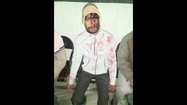 टाटगढ़: टॉडगढ़ थाना क्षेत्र में घर में घुसकर 15 से अधिक लोगों ने किया जानलेवा पथराव, पीड़ित परिवार ने उच्च अधिकारियों से की शिकायत