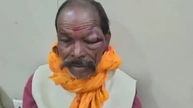 जयसिंहनगर: बनसुकली में अनियंत्रित बाइक गिरने से तीन घायल, डायल 112 स्टॉफ ने पहुंचाया अस्पताल