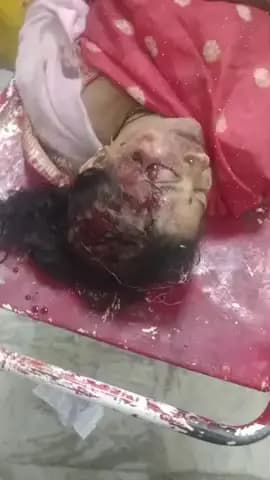 Meri Ma ka accident gata har ke pass hua Hai Thana Maihar ke pass