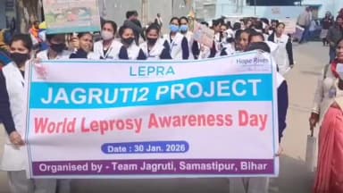 समस्तीपुर: वर्ल्ड लेप्रोसी अवेयरनेस डे पर समस्तीपुर सदर अस्पताल में कुष्ठ उन्मूलन जागरूकता रैली का आयोजन