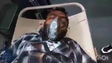 गभाना: भमरौला में युवक ने ममेरे भाई के सिर में मारी गोली, पुलिस ने गंभीर हालत में मेडिकल कॉलेज में कराया भर्ती