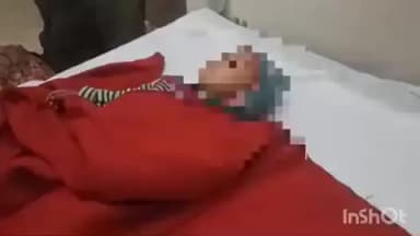 कैसरगंज: प्रधानपुराव गांव में खेलते समय खोलता चाय से झुलसी मासूम बच्ची, परिवार में मचा कोहराम, मेडिकल कॉलेज रेफर