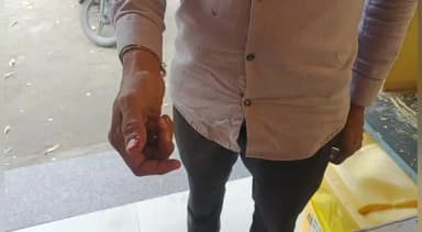 अंजड़: ग्राम भागसुर में कुत्ते ने युवक को काटा, अंजड़ CHC में इलाज जारी, आवारा कुत्तों के आतंक से लोग भयभीत