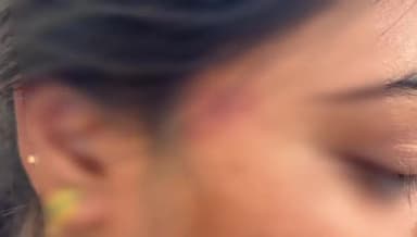 ಹೊಸಕೋಟೆ: ಶಿಕ್ಷಕಕನಿಂದಲೆ ಪತ್ನಿಗೆ ವರದಕ್ಷಿಣೆ ಕಿರುಕುಳದ ಆರೋಪ ಅವಾಚ್ಯ ಶಬ್ದಗಳಿಂದ ನಿಂದಿಸಿ ಹಲ್ಲೆ ಆರೋಪ