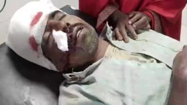 अगिआंव: खेत से लौटते वक्त किसान पर टूटा रफ्तार का कहर, पवना में बाइक की टक्कर से जिंदगी और मौत के बीच जंग में फंसा किसान