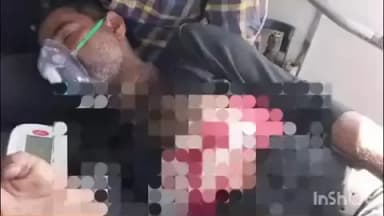 गोला गोकरणनाथ: गोला नगर में दिनदहाड़े युवक पर फायरिंग, पेट में लगी गोली, मामूली विवाद के बाद वारदात, आरोपी तमंचे सहित गिरफ्तार