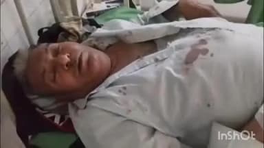 चित्तौड़गढ़: दमदम्मा में मामूली बात को लेकर एक व्यक्ति ने परिवार सहित मचाई धमाल, बड़े भाई और भतीजे पर 2 घंटे में तीन बार किया हमला