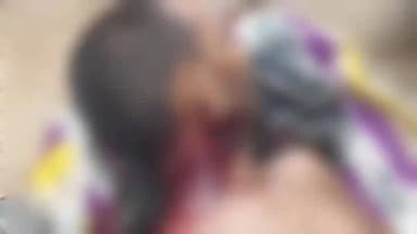 चकिया: जोगिया कला में युवक का रक्तरंजित शव मिलने से हड़कंप, हत्या की आशंका जताई जा रही है