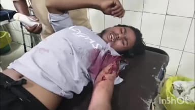 कोल: जीवनगढ़ में फाइरिंग से इलाके में दहशत, एक युवक को लगी गोली, दबंगों से दोस्त को बचाने पर युवक को पड़ा भारी