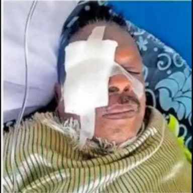 തിരുവനന്തപുരം: തിരുവനന്തപുരത്ത് 60കാരൻ്റെ കൺപോള കടിച്ചു പറിച്ച് തെരുവ് നായ്ക്കൾ
