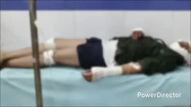 नैनपुर: पिंडरई मंडला सड़क मार्ग पर दर्दनाक हादसा, जंगली जानवर से टकराई बाइक, एक युवक की मौत, एक गंभीर