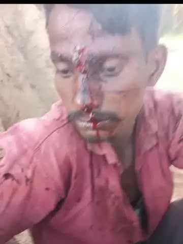 पिंडवाड़ा: मांडवाड़ा खालसा रोड पर बाइक सवार पर कुल्हाड़ी से हमला, बाइक सवार हुआ घायल