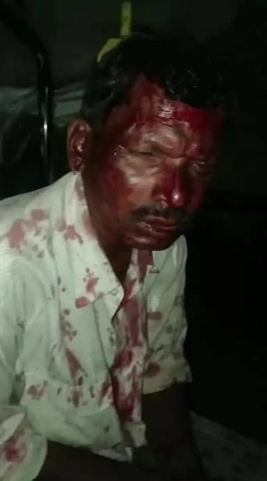 अशोकनगर के अंतर गत एक घटना सामने आई हे दिनांक 17/06/2026 को रात 12 बजे हुई भयानक लड़ाई मुंगावली पुलिस रिपोर्टनहीं लिखा