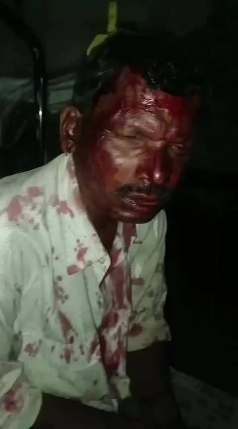अशोकनगर के अंतर गत एक घटना सामने आई हे दिनांक 17/06/2026 को रात 12 बजे हुई भयानक लड़ाई मुंगावली पुलिस रिपोर्टनहीं लिखा