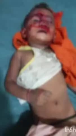ఖిలా వరంగల్: లేబర్ కాలనీలో వీధిలో ఆడుకుంటున్న ఇద్దరు పిల్లలపై పిచ్చికుక్కల దాడి.
