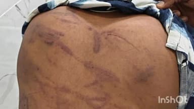 भीलवाड़ा: गुलाबपुरा से युवक का अपहरण, पैसे के लेनदेन को लेकर निर्वस्त्र कर बेरहमी से पीटा, 5 लाख की मांगी फिरौती