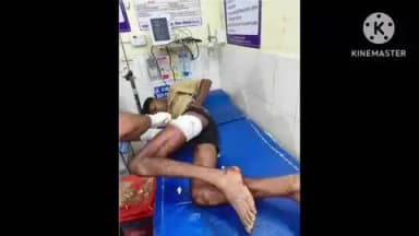 राजिम: ग्राम बम्हनी में आयोजित मेले के दौरान हुई चाकूबाजी, दो सगे भाई हुए जख्मी