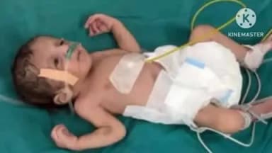 कुचामन सिटी: कलयुगी मां ने 3 दिन के मासूम को कुचामन अस्पताल के पालना गृह में छोड़ा, चिकित्सकों की तत्परता से बची जान